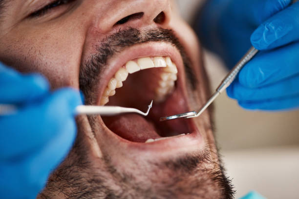 Best Dental Abscess Treatment in Monroe, NC